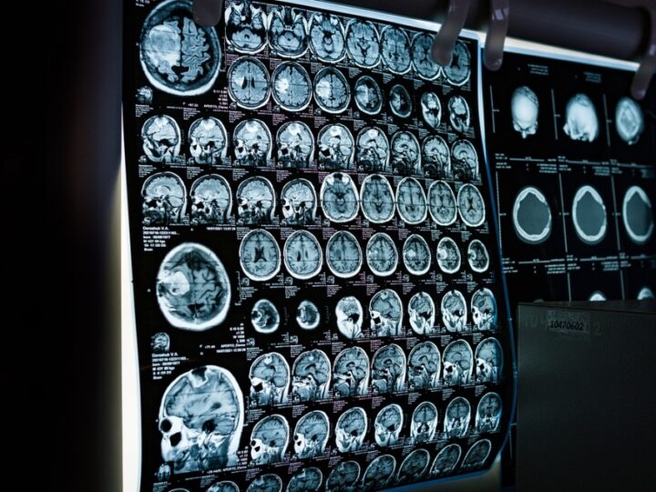 Wybór pomiędzy tomografią komputerową a rezonansem magnetycznym: Jakie są różnice i kiedy wykonać które badanie?